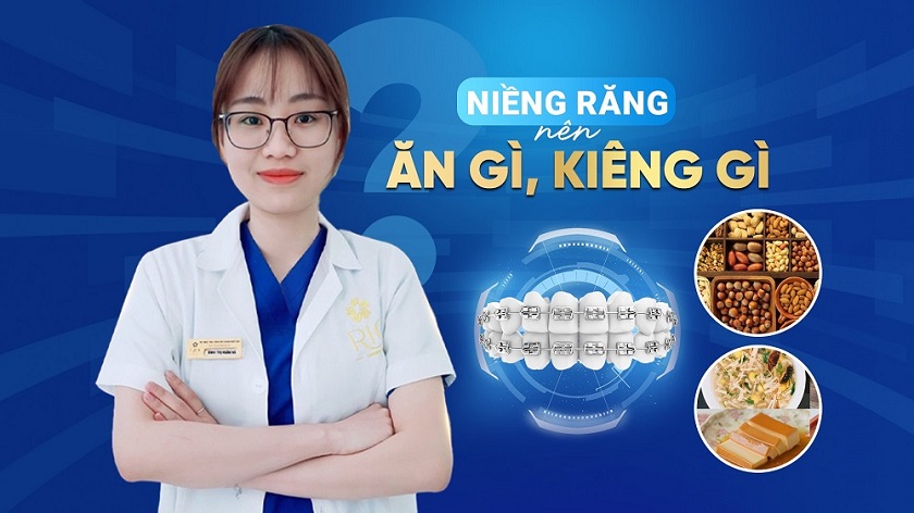 Niềng răng thẩm mỹ – Ưu đãi trọn gói chỉ từ 9tr9