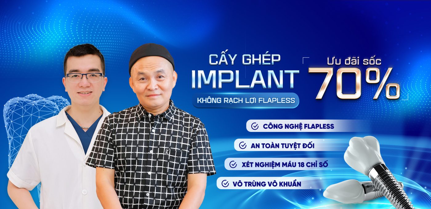 Cấy ghép Implant – Phục hình răng đã mất chỉ từ 3tr9