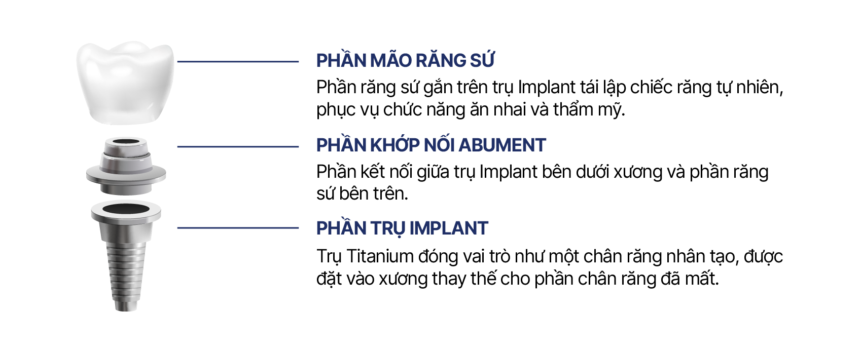 Cấu trúc răng Implant